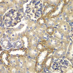 Anti-RAB5C antibody used in IHC (Paraffin sections) (IHC-P). GTX32828