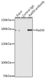Anti-Rad50 antibody used in Immunoprecipitation (IP). GTX32832