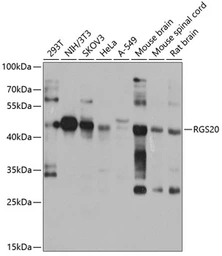 Anti-RGS20 antibody used in Western Blot (WB). GTX32838