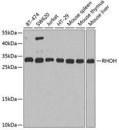 Anti-RHOH antibody used in Western Blot (WB). GTX32839