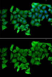 Anti-RHOH antibody used in Immunocytochemistry/ Immunofluorescence (ICC/IF). GTX32839