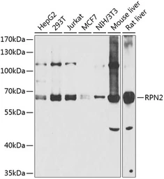 Anti-Ribophorin II antibody used in Western Blot (WB). GTX32840