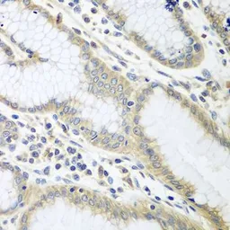 Anti-Ribophorin II antibody used in IHC (Paraffin sections) (IHC-P). GTX32840