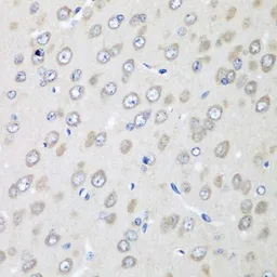 Anti-Ribophorin II antibody used in IHC (Paraffin sections) (IHC-P). GTX32840
