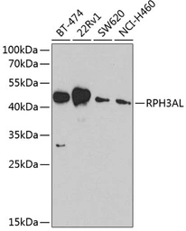 Anti-RPH3AL antibody used in Western Blot (WB). GTX32846