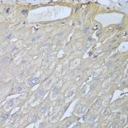 Anti-RPH3AL antibody used in IHC (Paraffin sections) (IHC-P). GTX32846