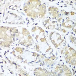 Anti-RPH3AL antibody used in IHC (Paraffin sections) (IHC-P). GTX32846