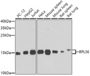 Anti-RPL36 antibody used in Western Blot (WB). GTX32847