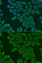 Anti-RPL36 antibody used in Immunocytochemistry/ Immunofluorescence (ICC/IF). GTX32847