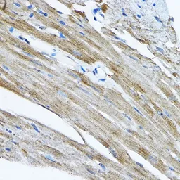 Anti-RPL36 antibody used in IHC (Paraffin sections) (IHC-P). GTX32847