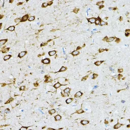 Anti-RPL36 antibody used in IHC (Paraffin sections) (IHC-P). GTX32847