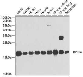 Anti-RPS14 antibody used in Western Blot (WB). GTX32849