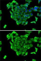 Anti-RPS14 antibody used in Immunocytochemistry/ Immunofluorescence (ICC/IF). GTX32849