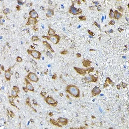 Anti-RPS14 antibody used in IHC (Paraffin sections) (IHC-P). GTX32849