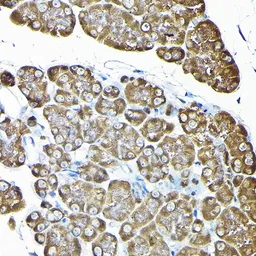 Anti-RPS14 antibody used in IHC (Paraffin sections) (IHC-P). GTX32849