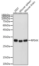 Anti-RPS4X antibody used in Western Blot (WB). GTX32850