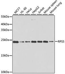 Anti-RPS5 antibody used in Western Blot (WB). GTX32851