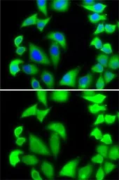 Anti-RPS5 antibody used in Immunocytochemistry/ Immunofluorescence (ICC/IF). GTX32851