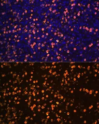 Anti-S100A12 antibody used in IHC (Paraffin sections) (IHC-P). GTX32854