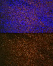 Anti-S100A12 antibody used in IHC (Paraffin sections) (IHC-P). GTX32854
