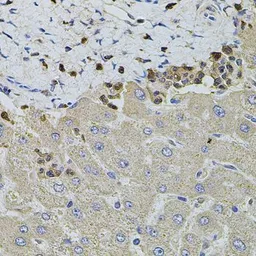 Anti-S100A12 antibody used in IHC (Paraffin sections) (IHC-P). GTX32854