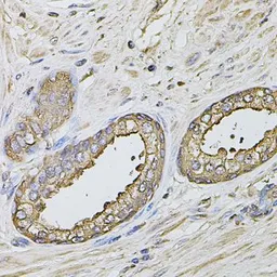 Anti-S100A12 antibody used in IHC (Paraffin sections) (IHC-P). GTX32854