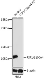 Anti-S100A4 antibody used in Western Blot (WB). GTX32855