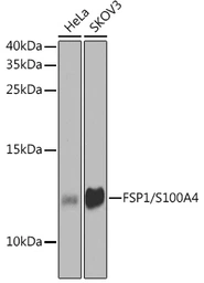 Anti-S100A4 antibody used in Western Blot (WB). GTX32855