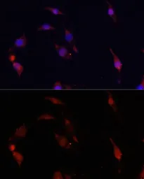 Anti-S100A4 antibody used in Immunocytochemistry/ Immunofluorescence (ICC/IF). GTX32855