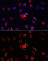 Anti-S100A4 antibody used in Immunocytochemistry/ Immunofluorescence (ICC/IF). GTX32855