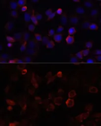 Anti-S100A4 antibody used in Immunocytochemistry/ Immunofluorescence (ICC/IF). GTX32855