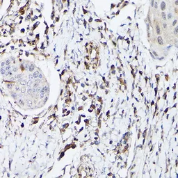 Anti-S100A4 antibody used in IHC (Paraffin sections) (IHC-P). GTX32855