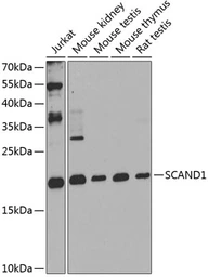Anti-SCAND1 antibody used in Western Blot (WB). GTX32858