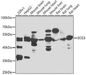 Anti-SCG3 antibody used in Western Blot (WB). GTX32859