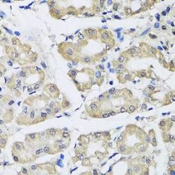 Anti-SCG3 antibody used in IHC (Paraffin sections) (IHC-P). GTX32859