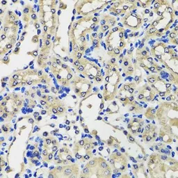 Anti-SCG3 antibody used in IHC (Paraffin sections) (IHC-P). GTX32859