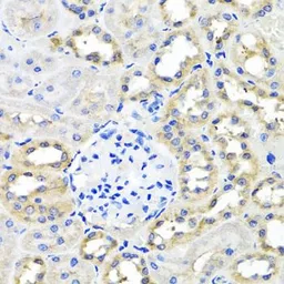 Anti-SCG3 antibody used in IHC (Paraffin sections) (IHC-P). GTX32859