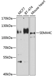 Anti-SEMA4C antibody used in Western Blot (WB). GTX32865