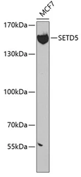 Anti-SETD5 antibody used in Western Blot (WB). GTX32867