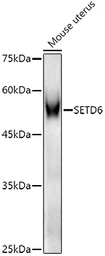 Anti-SETD6 antibody used in Western Blot (WB). GTX32868
