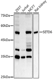 Anti-SETD6 antibody used in Western Blot (WB). GTX32868