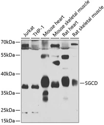 Anti-delta Sarcoglycan antibody used in Western Blot (WB). GTX32871