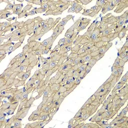 Anti-delta Sarcoglycan antibody used in IHC (Paraffin sections) (IHC-P). GTX32871