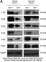 Anti-delta Sarcoglycan antibody used in Western Blot (WB). GTX32871