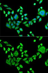 Anti-SH3GL2 antibody used in Immunocytochemistry/ Immunofluorescence (ICC/IF). GTX32872