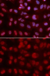 Anti-SIN3A antibody used in Immunocytochemistry/ Immunofluorescence (ICC/IF). GTX32874