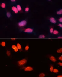 Anti-SIRT1 antibody used in Immunocytochemistry/ Immunofluorescence (ICC/IF). GTX32875