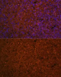 Anti-SLAMF7 antibody used in IHC (Paraffin sections) (IHC-P). GTX32876