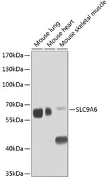 Anti-SLC9A6 antibody used in Western Blot (WB). GTX32878