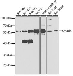 Anti-SMAD5 antibody used in Western Blot (WB). GTX32881